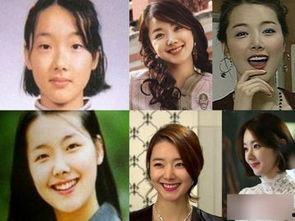 韩国整容明星整容前后图片